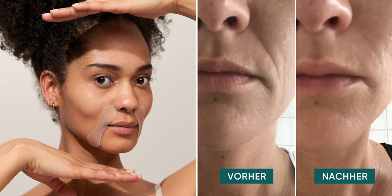Patch Contour de la Bouche à L'Acide Hyaluronique Réutilisable - Apricot