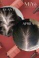 Sérum Cheveux - Densifiant Anti-chute - MiYé